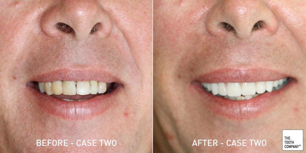 Cosmetic Dentistry